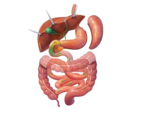 Diagram of internal organs showing a gastric sleeve procedure